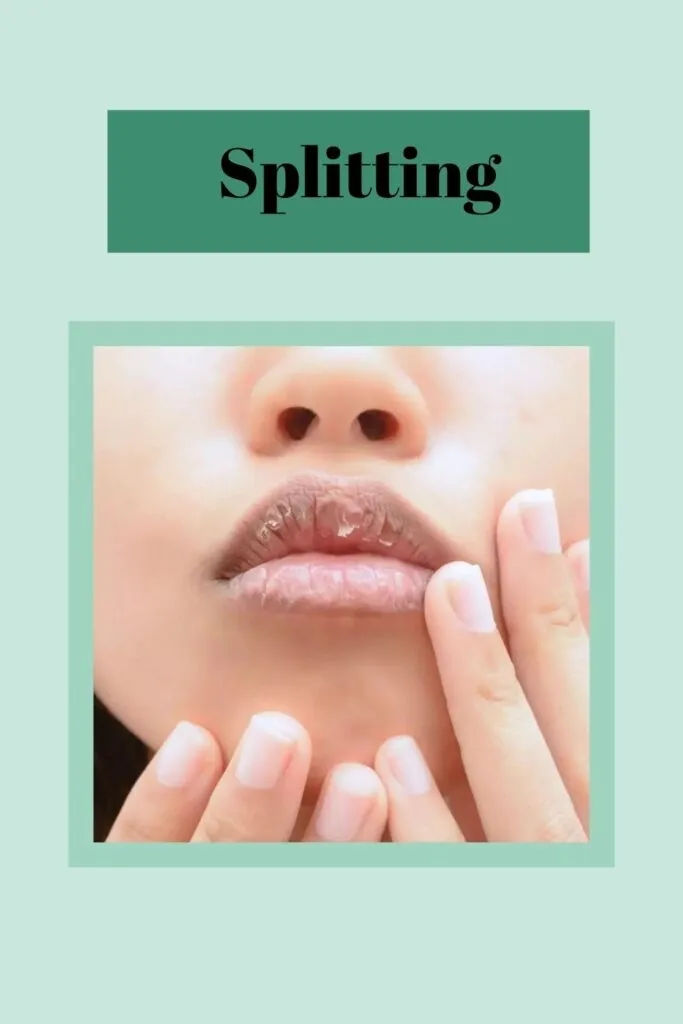A girl is showing her splitting lips A girl is showing her splitting lips - lip care tips