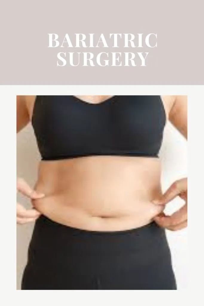 A women is showing her belly fat A women is showing her belly fat - Weight Loss Surgery