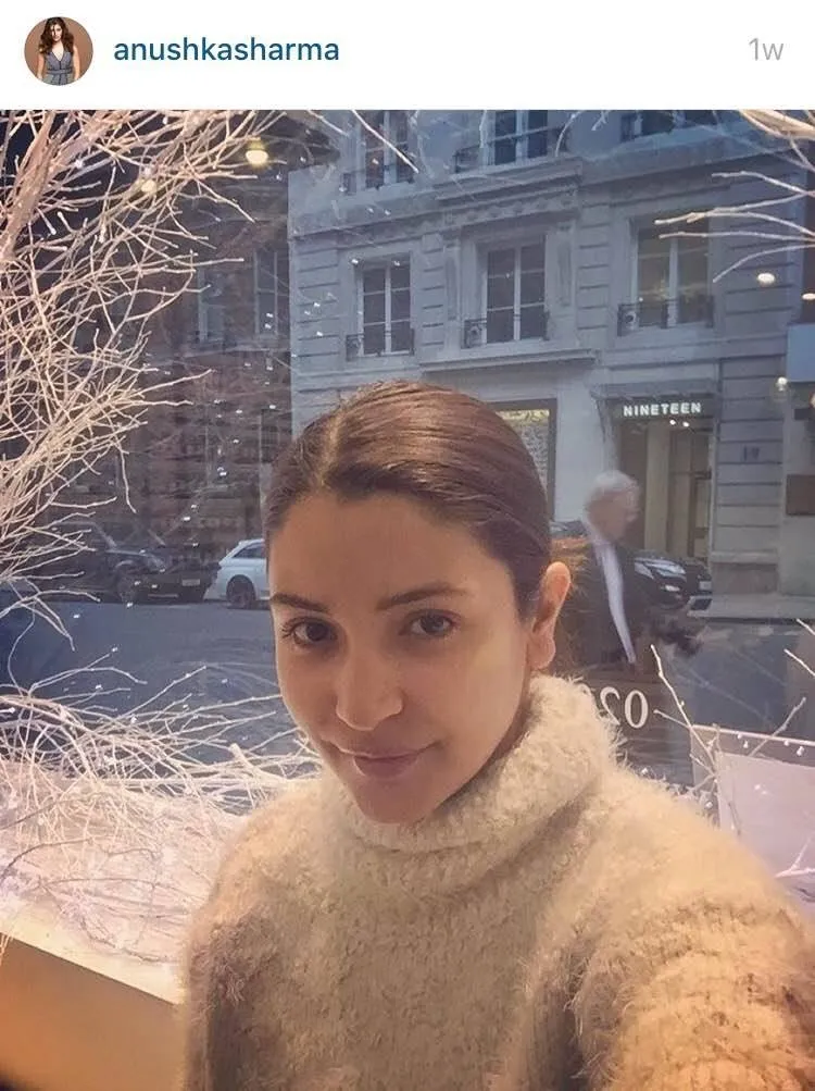 Anushka Sharma without makeup Anushka Sharma without makeup