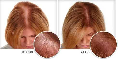 Hair Growth Tips for Women