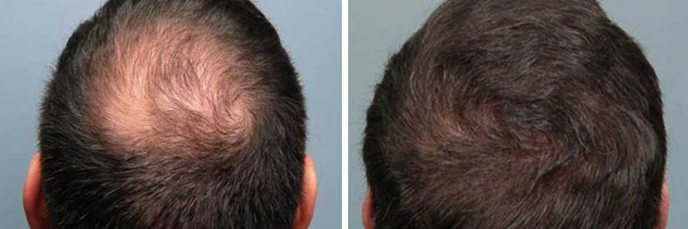 Hair Growth Tips