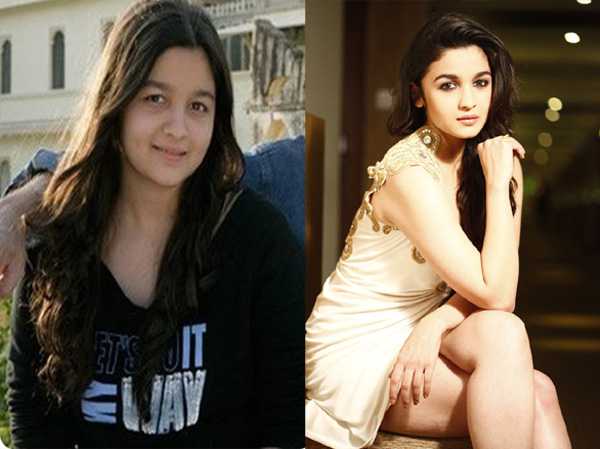 Alia Bhatt weight loss before and after pics -  Fat to Fit Actress