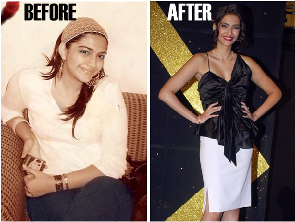 Sonam Kapoor weight loss transformation pics - Fat To Fit Actress bollywood