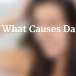 What Causes Dandruff