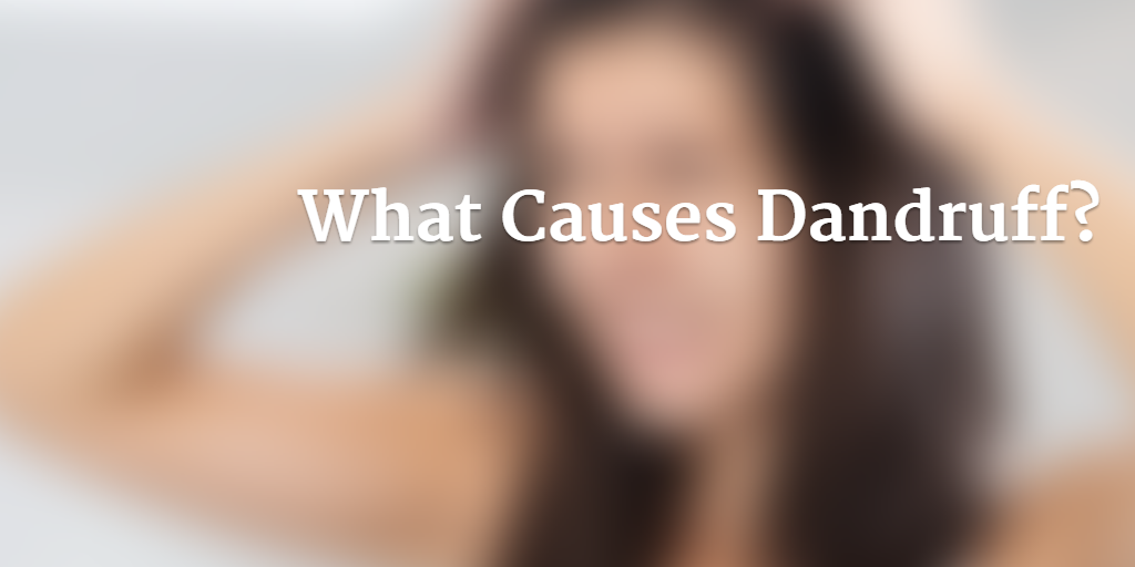 What Causes Dandruff