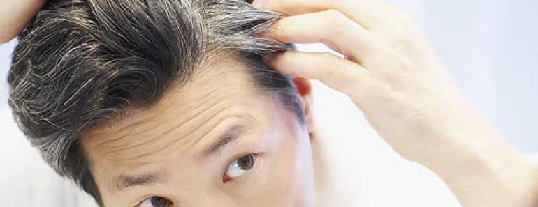 premature gray hair