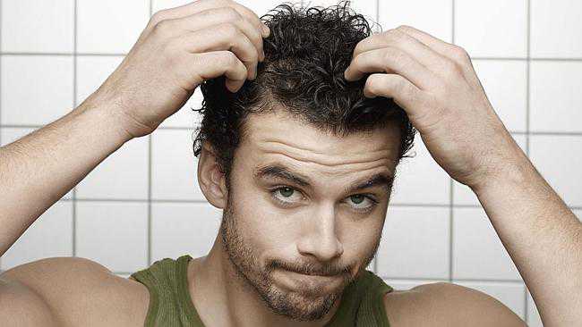 hair loss men