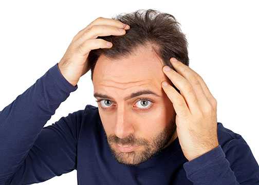 How to Treat Male Pattern Hair Loss