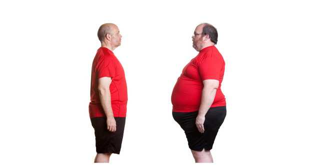 weight loss surgery
