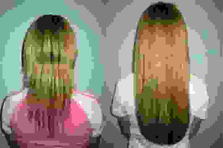 Hair Growth