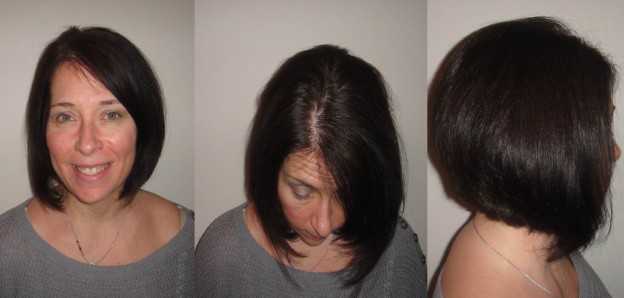 How to Prevent Hair Loss While Losing Weight 1