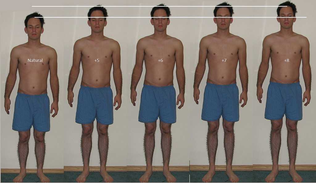 height lengthening surgery