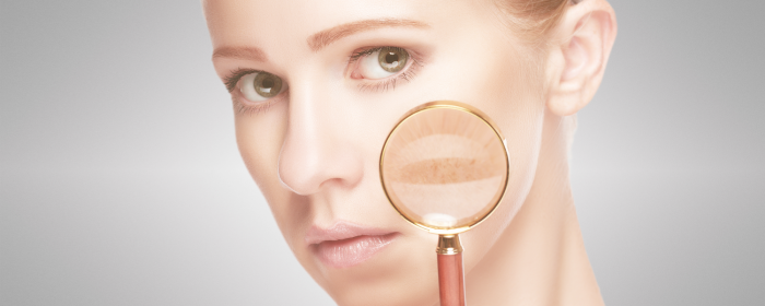 Dangerous Health Effect of LED & CLF Bulbs 5 skin damage