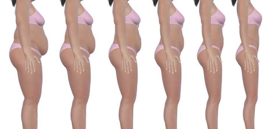mommy makeover mommy makeover