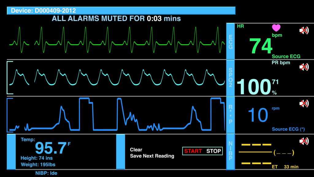 Top 10 EKG/ECG Monitors Reviews