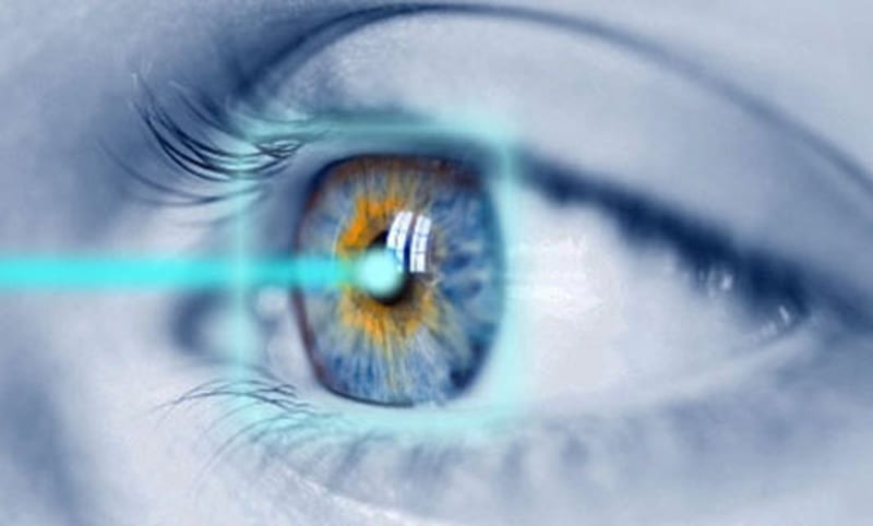 lasik eye surgery