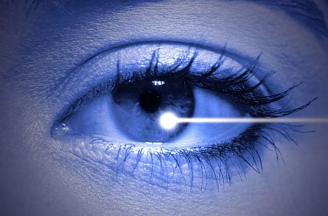 lasik eye surgery