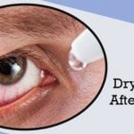dry eyes after lasik