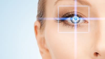 laser vision correction