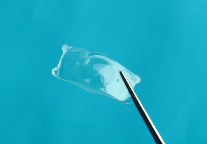 ICL: Implantable Collamer Lenses Explained
