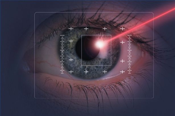 lasik surgery tips