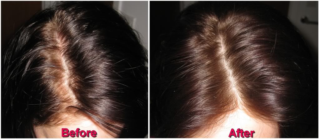 Top 5 Dry Shampoos in India