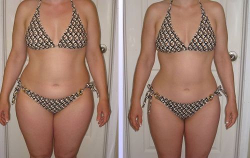 HCG Weight Loss