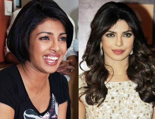 Bollywood Divas Who Opted Skin Lightening Treatment - Find ...