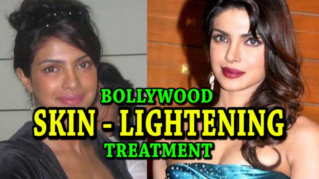 Bollywood Divas who opted Skin Lightening Treatment