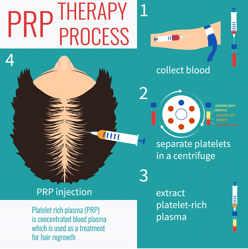 hair transplant therapy process