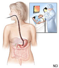 endoscopy endoscopy