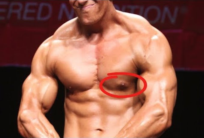 steroids effects