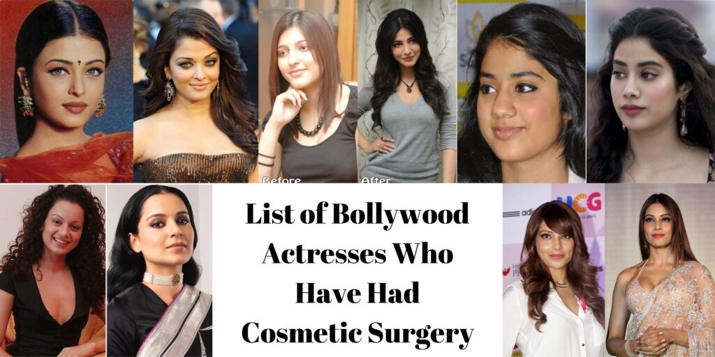 List of Bollywood Actresses Who Have Had Cosmetic Surgery