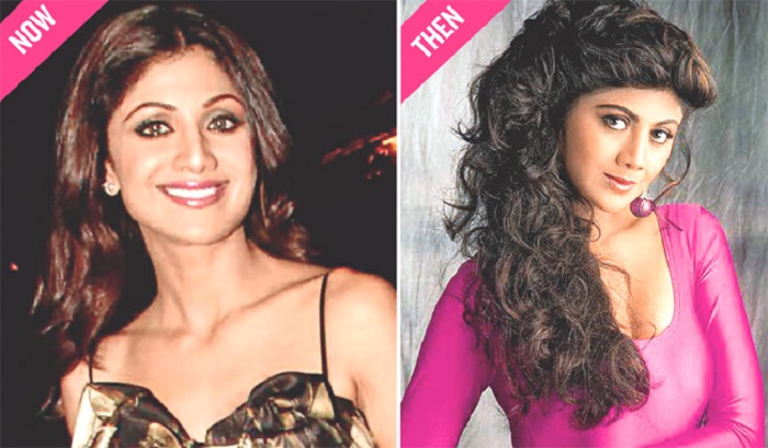 Shilpa Shetty before and after pics of cosmetic surgery - bollywood actress surgery