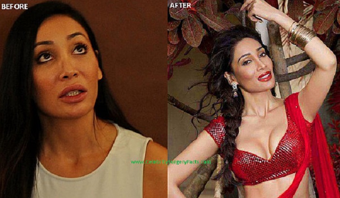 Sofia Hayat Bollywood Actress Plastic Surgery