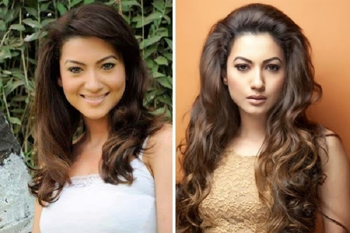 Gauhar Khan before and after pics of cosmetic surgery - surgery of bollywood actress