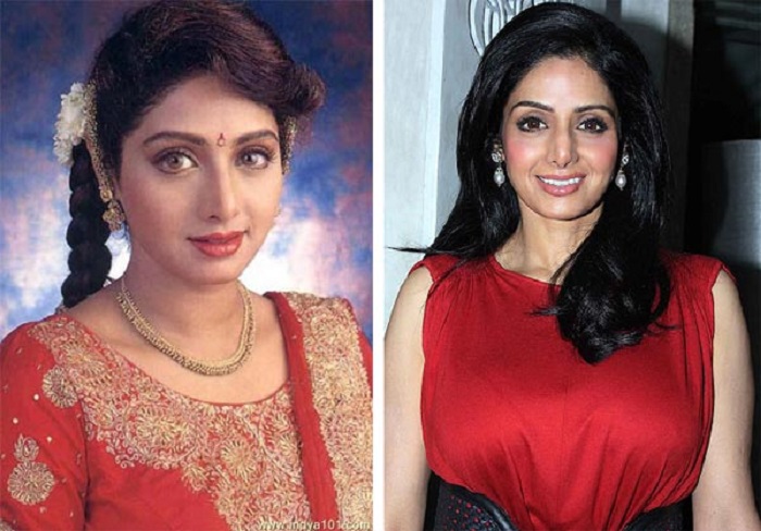Sridevi Bollywood Actress Plastic Surgery