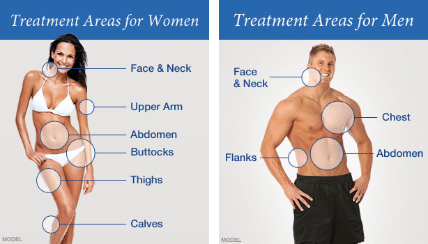 liposuction fat loss surgery
