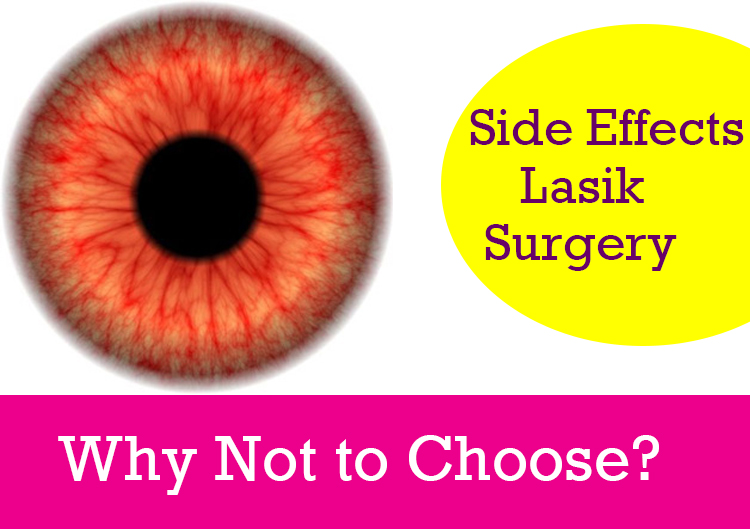 Side effects lasik surgery