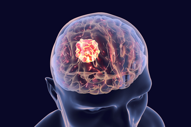 How Writing Improves Your Brain Learning Activities