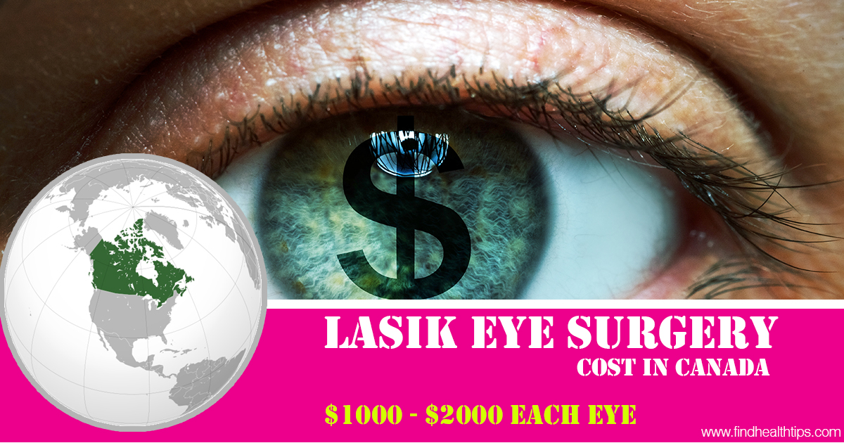 How Much Does Lasik Eye Surgery Cost (Cheap To High)? Find Health Tips