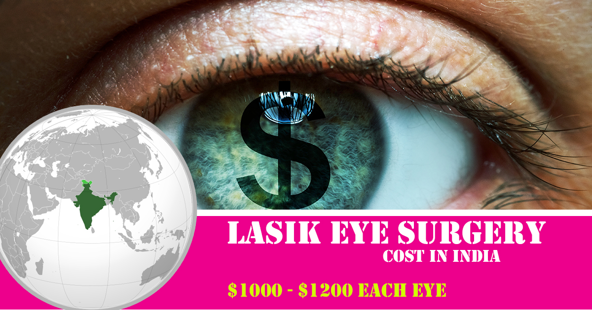 lasik eye surgery cost in India