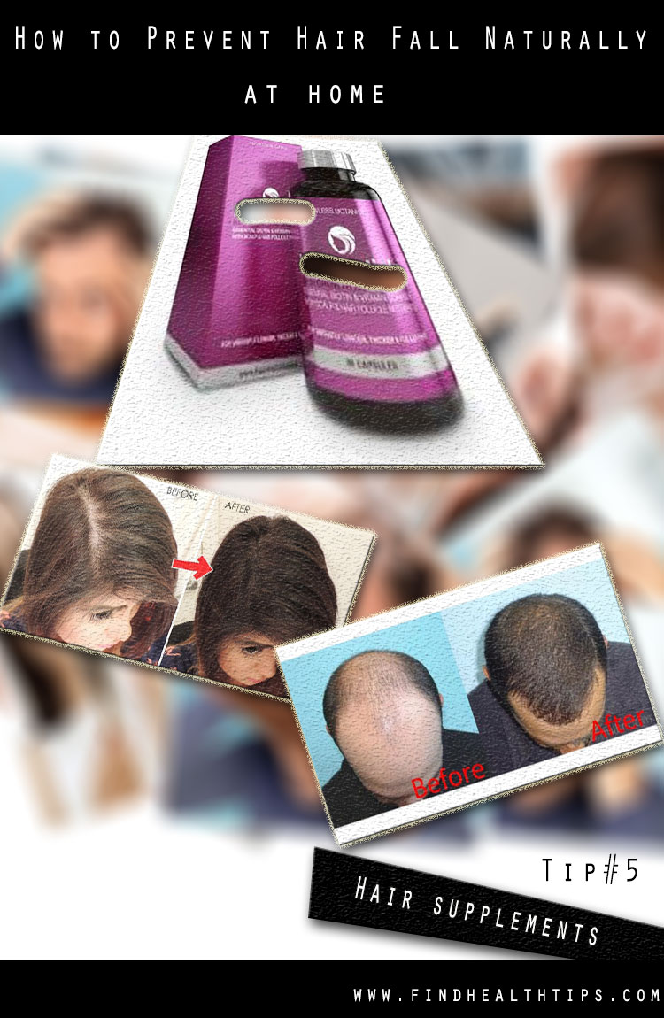 Prevent Hair Fall Naturally Tips