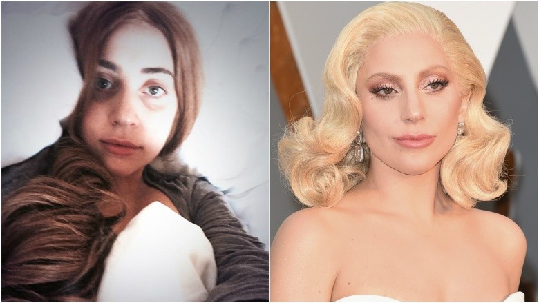 Lady Gaga with makeup and  without makeup photos - hollywood actresses without makeup 2022