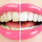 4 Common Dental Health Problems and How to Assess Your Symptoms 1