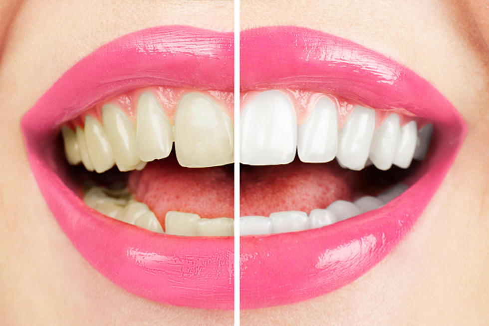 4 Common Dental Health Problems and How to Assess Your Symptoms 1