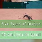 insects eyeballs