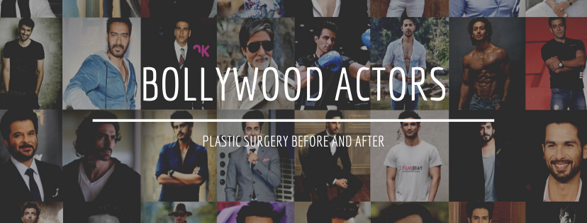 Bollywood Male Actors Plastic Surgery Before And After