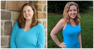 Breast Reduction without Surgery