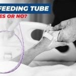 Feeding Tube